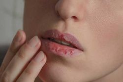 Thấy môi có dấu hiệu này, hãy nhanh chóng đi gặp bác sĩ ngay kẻo căn bệnh nguy hiểm đang 'gõ cửa'