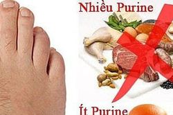 7 thực phẩm mà người mắc bệnh gout nên tránh xa