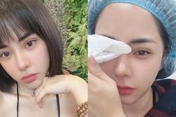 Bạn gái Huỳnh Anh công khai tiếp tục thẩm mỹ