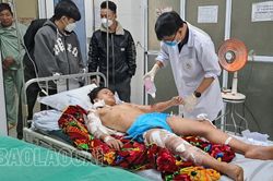 Người bị chó cắn thương tích nặng là sinh viên Trường Cao đẳng Lào Cai