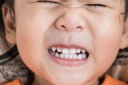 Tại sao trẻ lại nghiến răng?