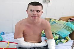 Nam du khách nước ngoài bị chó cắn ở Nha Trang chưa thể xuất viện