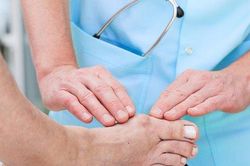 Bệnh gout được chữa như thế nào?