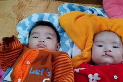 MS 824: Xót xa gia cảnh cặp song sinh mắc dị tật cần được phẫu thuật sớm