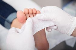 Dấu hiệu ở chân cảnh báo mỡ máu cao bất thường