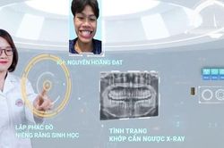 Niềng răng sinh học: mang công nghệ vào niềng răng