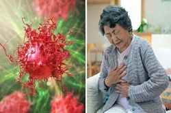 Dấu hiệu phổ biến nhất của ung thư di căn