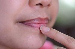 Môi có dấu hiệu này là cơ thể đang cảnh báo vấn đề sức khỏe nghiêm trọng, đừng chủ quan