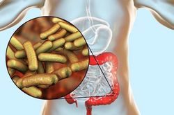 Cảnh báo bệnh lý do vi khuẩn Shigella: Những điều cần biết để bảo vệ sức khỏe