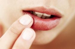 7 cách trị môi khô, nứt nẻ nhanh chóng và hiệu quả