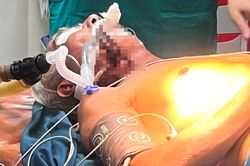 Người đàn ông bị thanh sắt dài 30 cm đâm xuyên cổ