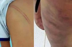 Rơi nước mắt chuyện những đứa trẻ bị bố và mẹ kế hành hạ dã man
