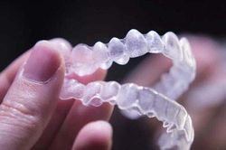 Những điều ít biết về phương pháp niềng răng từ thế giới cổ đại