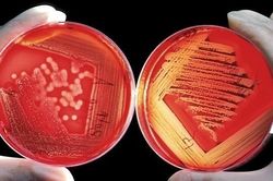 Cảnh báo căn bệnh bắt nguồn từ việc ăn tiết canh
