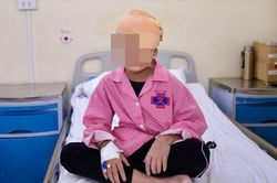 Nhiều nơi từ chối mổ, bé trai đau đớn vì khối u khổng lồ ở mắt