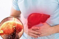 5 thói quen ở người Việt khiến men gan tăng cao nhiều người không ngờ tới!
