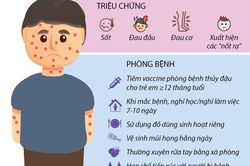 Hà Nội: Số ca mắc thủy đậu tăng cao ở nhóm tuổi mầm non, tiểu học