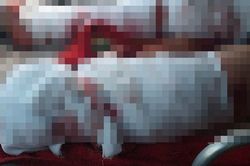 Vụ 2 học sinh bị thương sau tiếng nổ lớn: Một nạn nhân đã tử vong