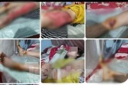 Thực hư tin 'con dùng xe máy kéo lê mẹ đẻ trên đường' ở Yên Bái