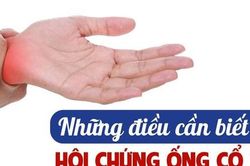 Hội chứng ống cổ tay: Nguyên nhân, biểu hiện và điều trị