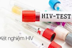 'Nóng' tình trạng lây nhiễm HIV trong nhóm MSM ở Khánh Hòa