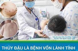 Bệnh thủy đậu vào mùa, cha mẹ không được chủ quan!