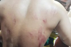 Một người dân bị chấn thương nặng do voi rừng tấn công