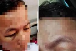 Hiệu trưởng đánh hiệu phó phải nhập viện vì chuyện mở cổng trường