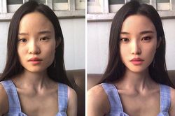 Hối hận vì phẫu thuật cắt mí