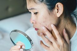 Đau lòng vì da mụn nhưng phải trang điểm mỗi ngày