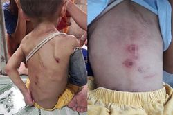 Hội Bảo vệ quyền trẻ em TP.HCM ra công văn khẩn vụ bé trai nghi bị bạo hành ở Hóc Môn