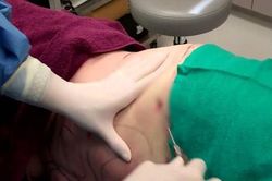 Một trường hợp tử vong sau khi phẫu thuật thẩm mỹ