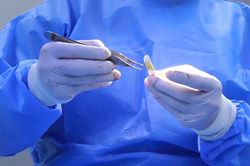 Nâng mũi cấu trúc và những biến chứng muộn
