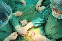 Bệnh viện Sản Nhi Nghệ An: 3 cuộc đại phẫu cứu sống em bé 20 ngày tuổi