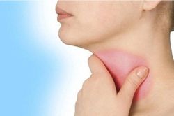 4 quy tắc để không bị viêm họng 'giày vò' trong mùa hè nắng nóng