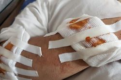 Thanh niên ở Hà Nội trọng thương khi gặp nhóm hô 'chém chết'