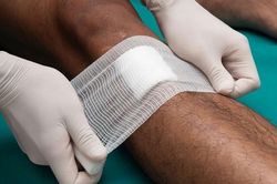 Băng dán vết thương kháng khuẩn của tiến sĩ Việt