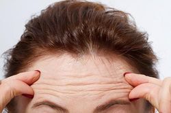 Bí quyết giúp bạn 'tẩy' nếp nhăn trên trán dễ dàng và hiệu quả