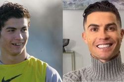 Diện mạo khác lạ của Beckham, Ronaldo sau khi... làm răng