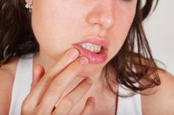 Tại sao cơ thể dị ứng loại thực phẩm trước đây không bị?