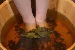 Các phương pháp điều trị suy giãn tĩnh mạch chi dưới