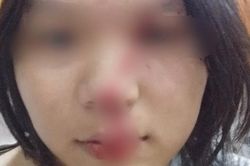 Đồng Nai: 4 mẹ con cầu cứu công an vì bị bạo hành