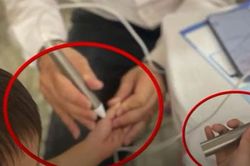 Một số đơn vị, cá nhân dùng 'bút đo vi chất' để đo vi chất cơ thể trẻ em, bán thực phẩm chức năng, Sở Y tế Hà Nội nói gì?
