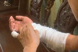 Khởi tố vụ án người đàn ông bị chém đứt lìa cánh tay ở Hà Nội