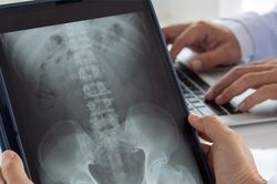 Phim X-quang hé lộ nguyên nhân ít ngờ khiến bệnh nhân ho dai dẳng