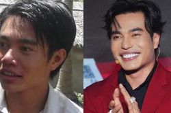 Lê Dương Bảo Lâm lộ diện mạo thời chưa 'dao kéo'