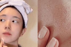 4 thói quen chăm da khiến lỗ chân lông ngày càng to