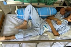 Mẹ đơn thân quẫn trí vì không còn tiền lo cho con trai gặp nạn