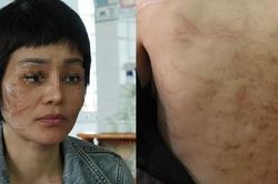 Người chồng bị tố bạo hành vợ bầu 7 tháng như thời trung cổ khai gì?