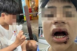 Nam sinh 14 tuổi ở Đà Nẵng bị đánh hội đồng dã man: Gãy 4 chiếc răng, nhấn xuống biển